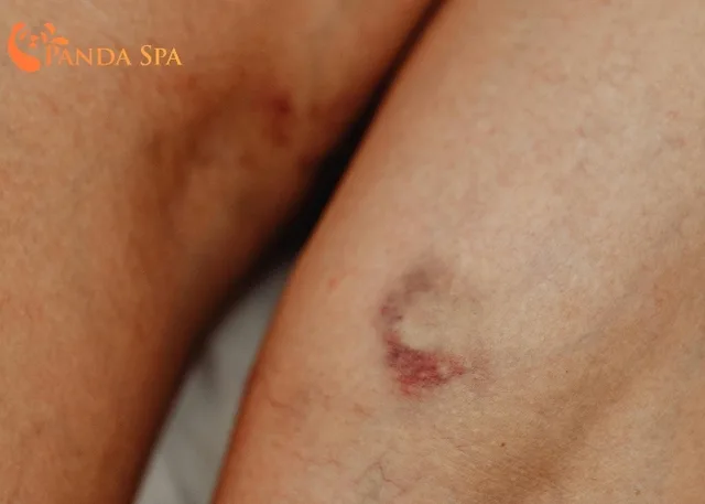 What are the benefits of foot massage?