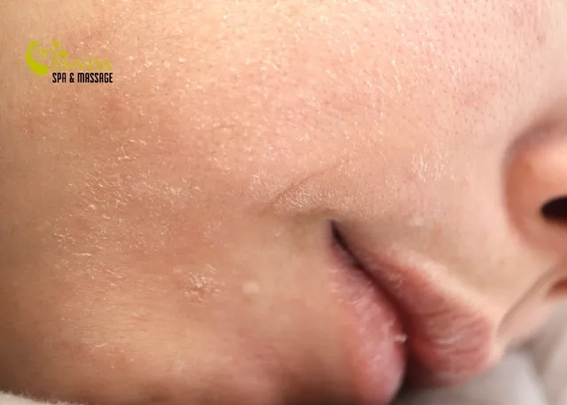 Top 8 Gentle Cleansers for Sensitive Skin – Healthy & Calm